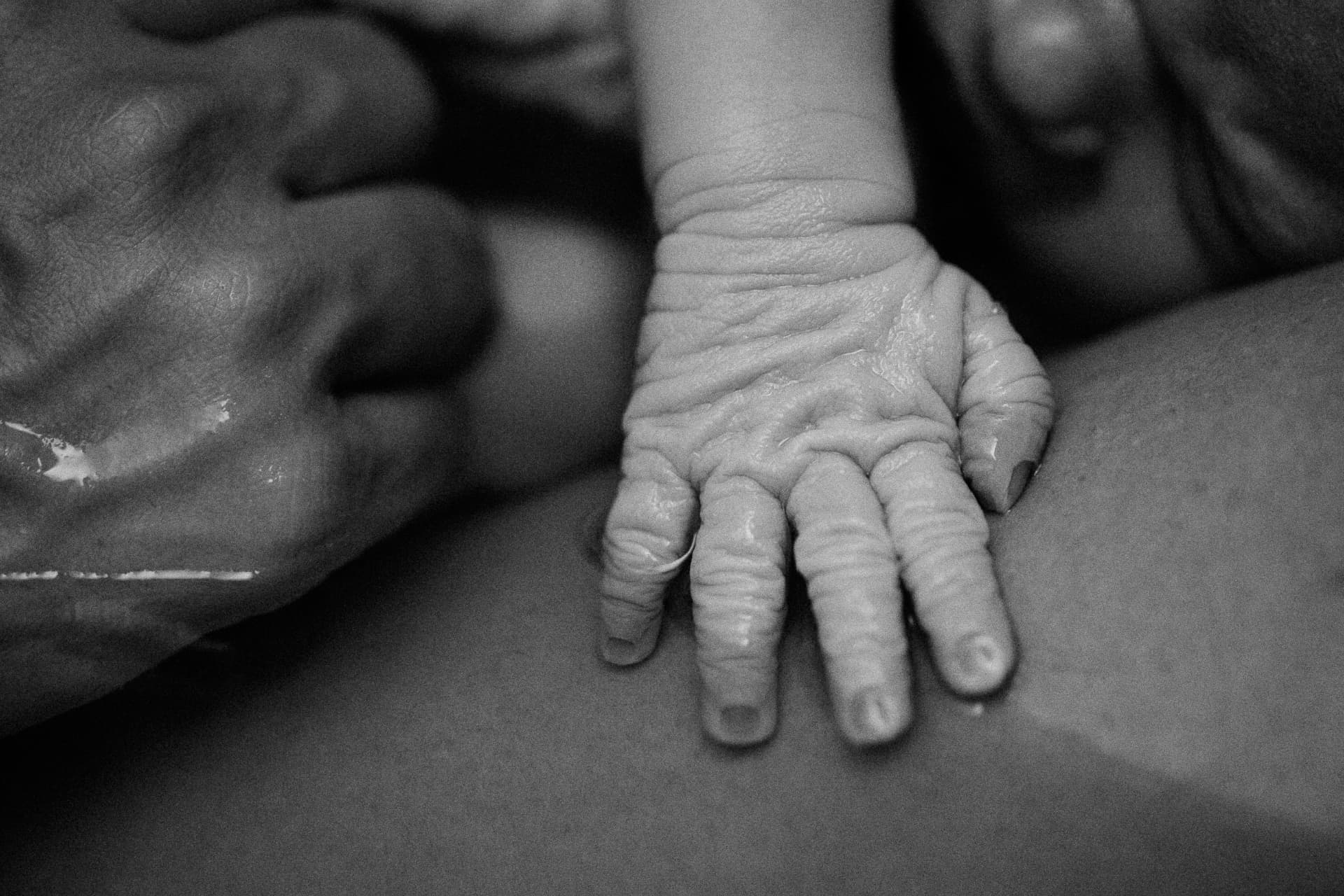 Mãozinha do recém-nascido aberta sobre a pele da mãe, em preto e branco